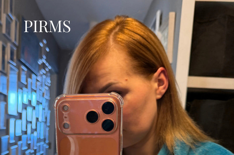 Pirms